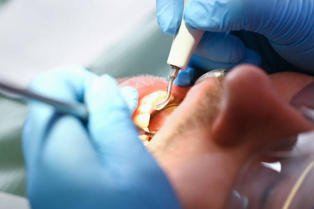 Best 24-Hour Emergency Dentist in Bensley, VA