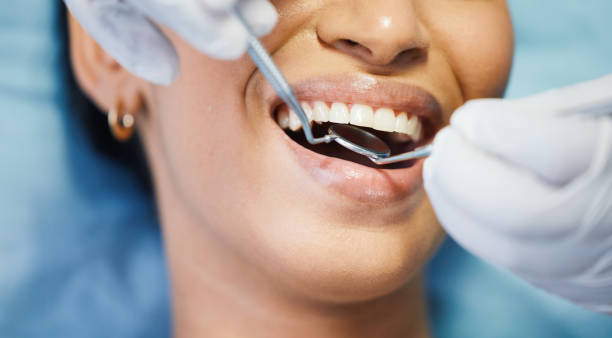 Best Emergency Dental Care for Abscessed Tooth in Bensley, VA