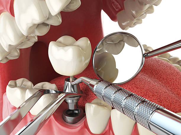 Best Broken or Cracked Tooth Emergency Dentist in Bensley, VA